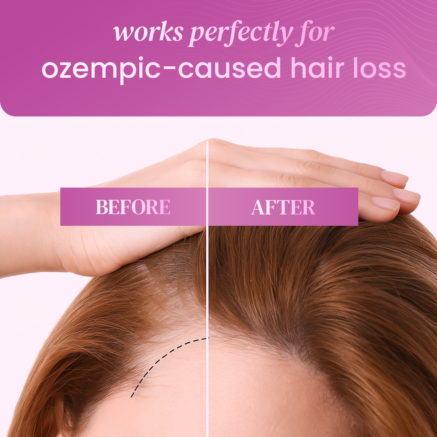 hair growth gummies with biotin & vitamins