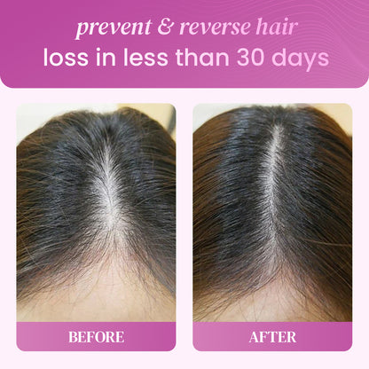hair growth gummies with biotin & vitamins